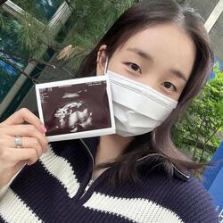 백아연 임신 5개월, '용띠맘' 합류에 누리꾼 축하 봇물...딸 '용용이' 기대