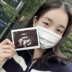 백아연, 5개월 임신 소식 전해… "태명은 '용용이', 딸입니다"
